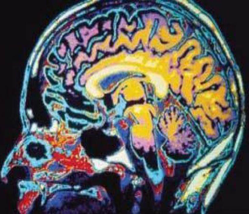 Head Injury Treatment and Brain Injury Care by Dr Tarun Kumar Adukia at Neuro Clinic Ranchi